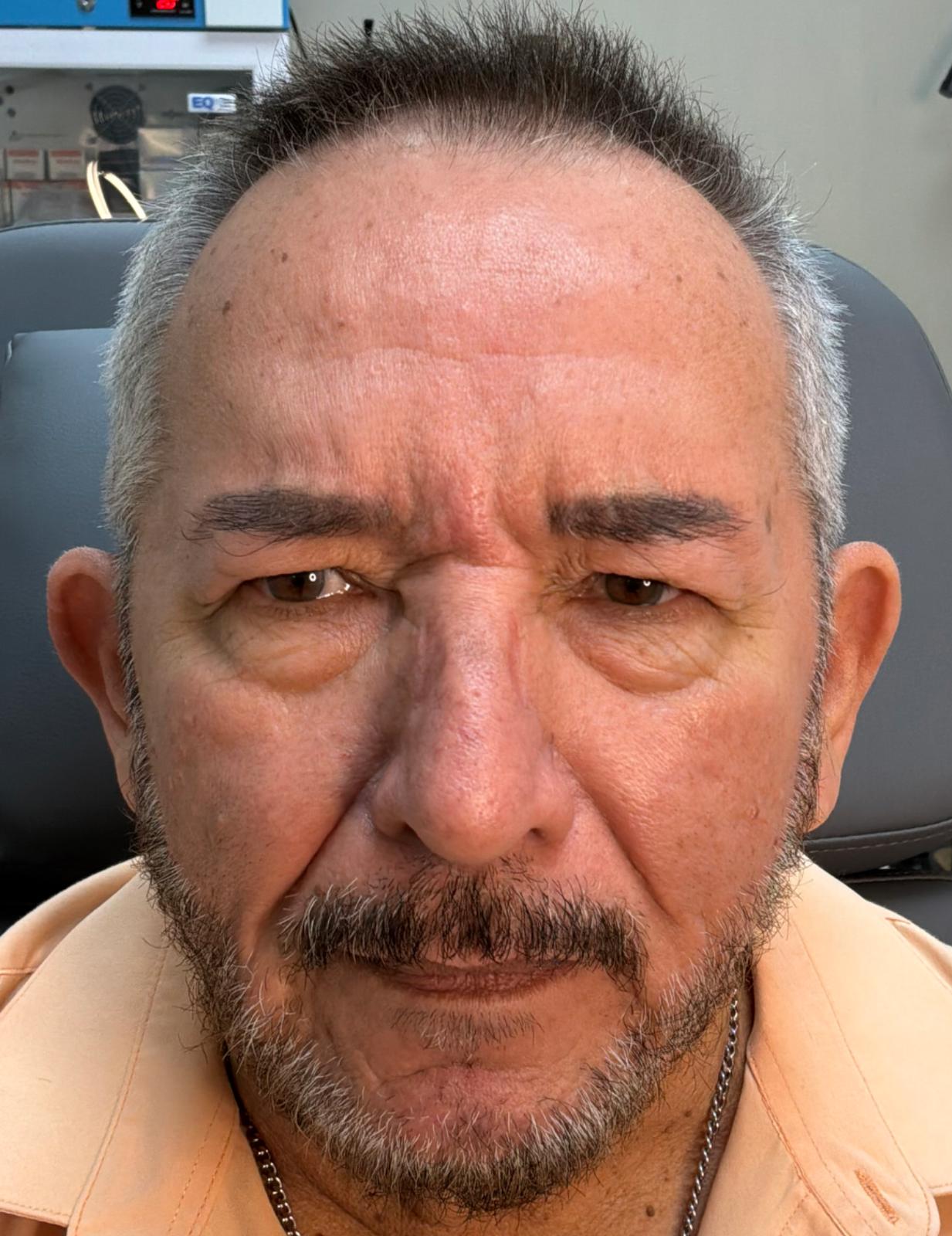unnamed image
